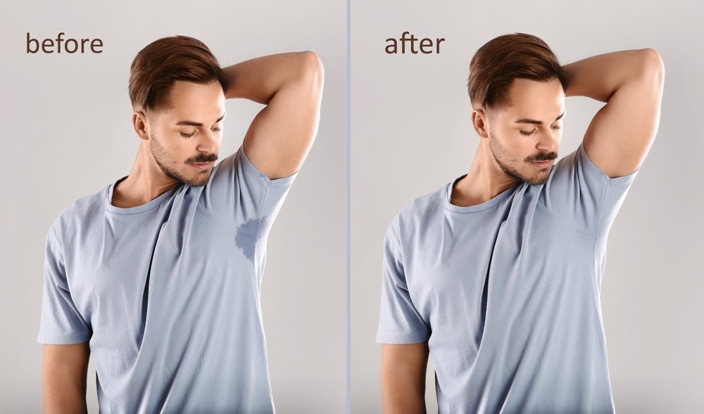 Ropa para hiperhidrosis